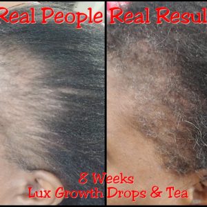 MULTI-USE | HAIR GROWTH TEA (30-90 DAY SUPPLY)